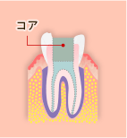 04.根管治療の流れ